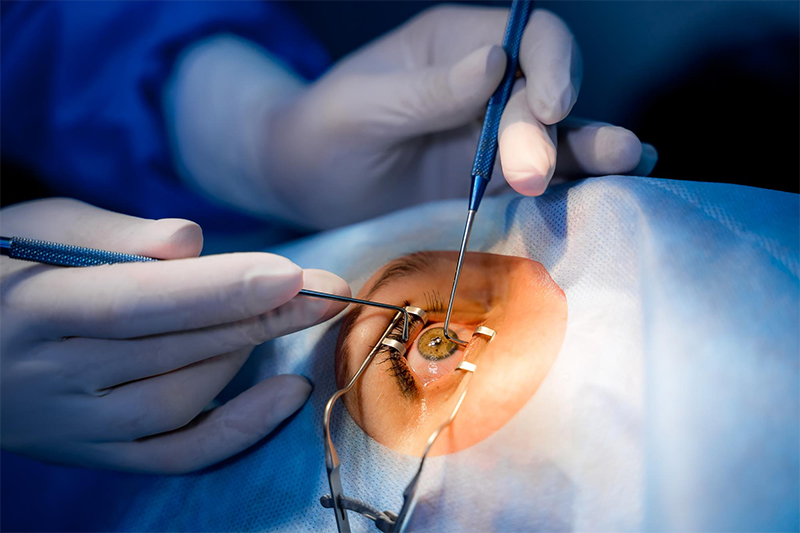 Legal Implications for When a Patient Becomes Blind During Surgery