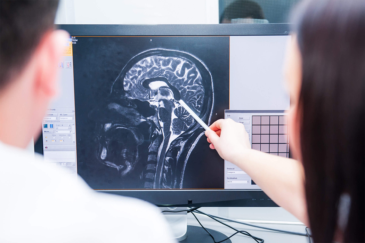 Traumatic Brain Injury (TBI)